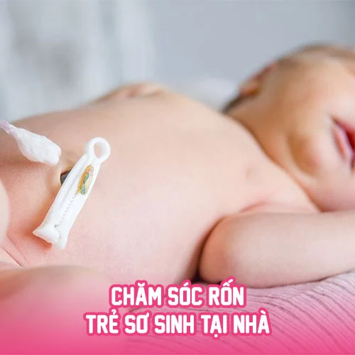 ron tre so sinh shopconyeugiasi 1 c892fffc843a4c4aa2a435a39ea3b0d9 77b65b98e4374fb9a69b2f09a1dd64a9